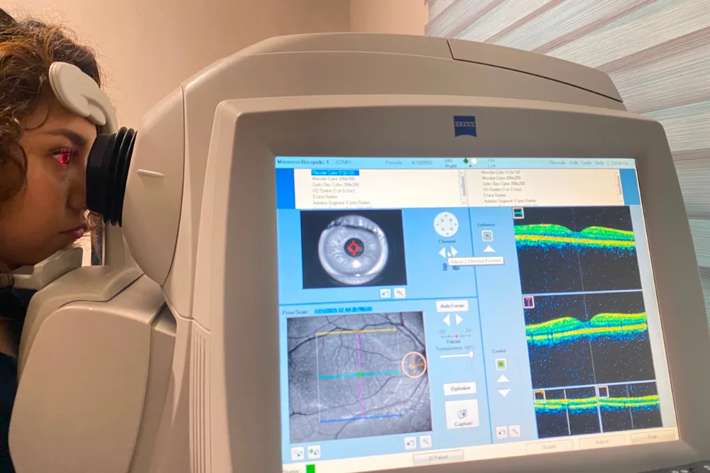 Tomografía de retina y nervio óptico